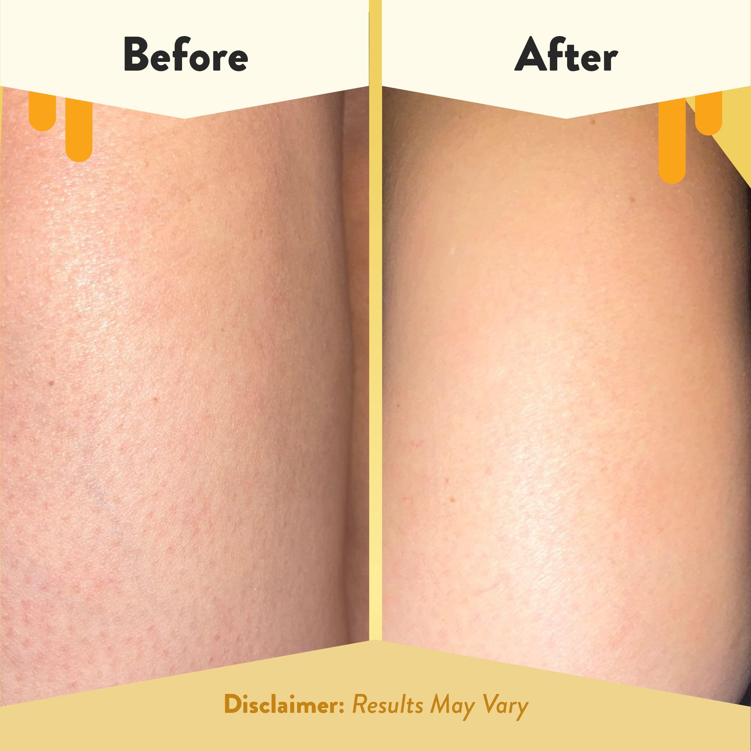 ECZEMA HONEY ECZEMA HONEY Soothing Body Wash - Daily Shower Gel & Eczema Treatment - Sensitive Skin Body Wash for Adults, Kids, & Babies - Body Cleanser for Eczema Relief (13 Oz)