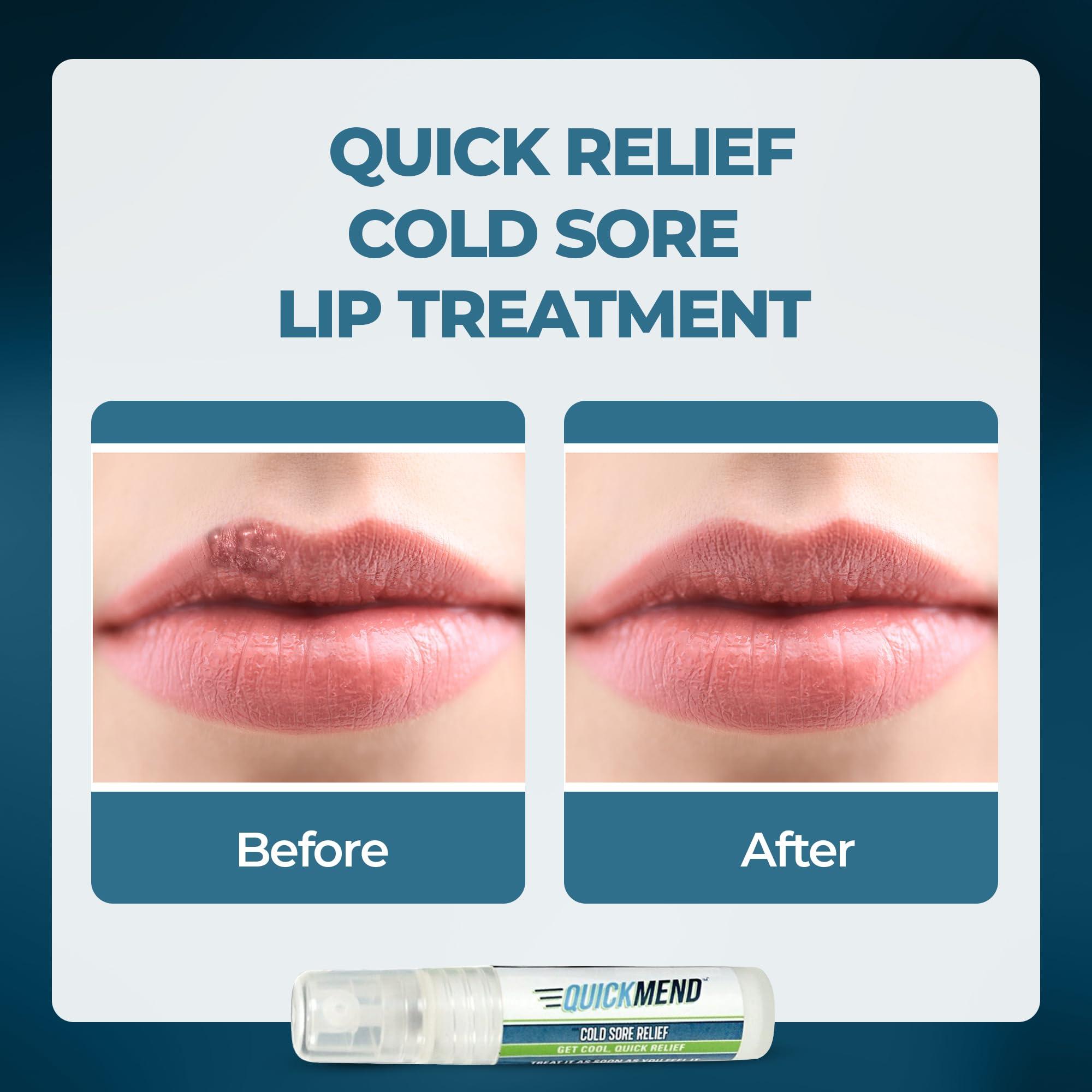 Quick Mend Quickmend Cold Sore Relief Lip Treatment with Pump Dispenser, 4.5 ml / .15 oz.
