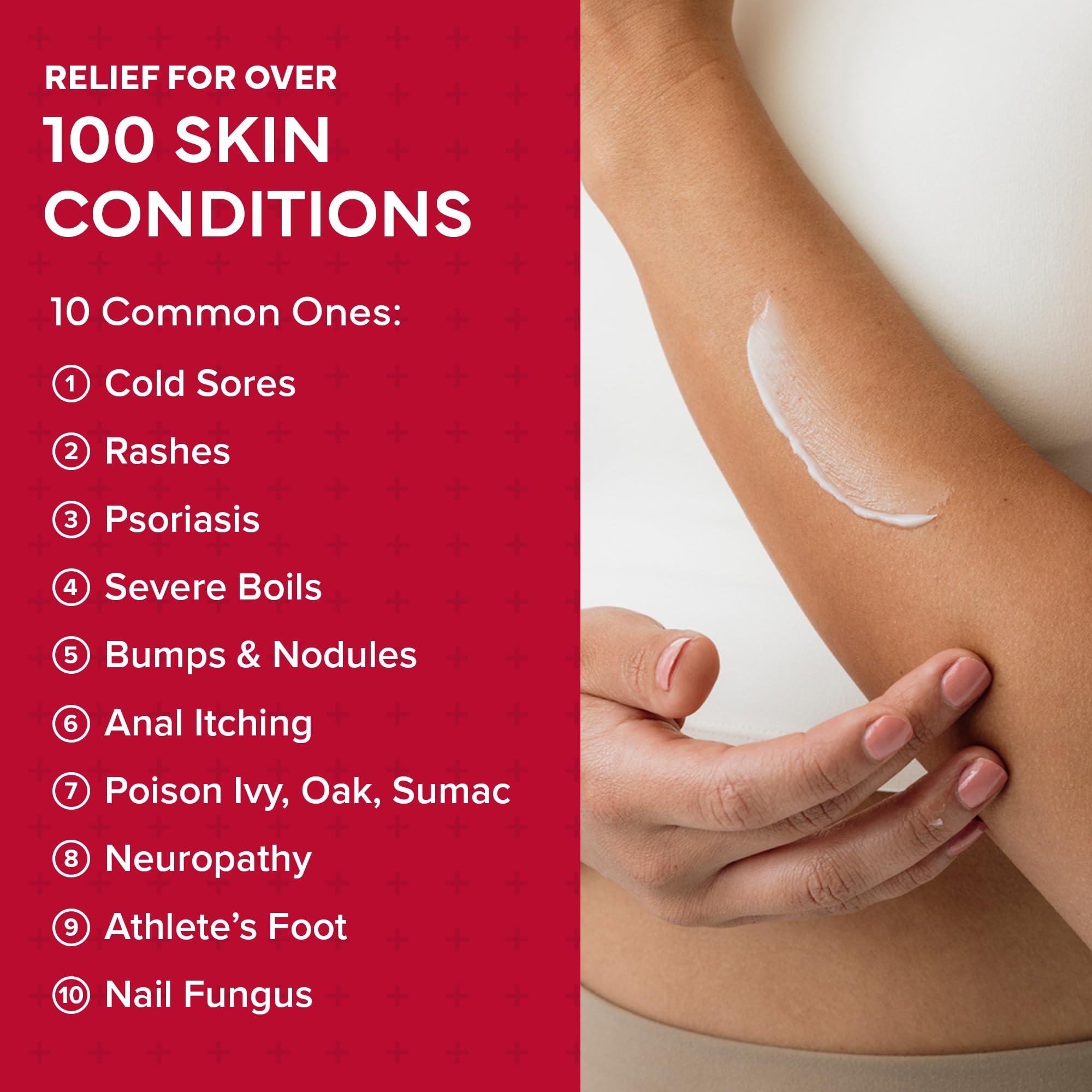 emuaid EMUAIDMAX First Aid Homeopathic Ointment, Natural Fast-Acting Topical Ointment for Resistant Skin Conditions, Reduces Itching, Pain, and Swelling, On-The-Go Travel Size, 0.35oz, 2 Pack