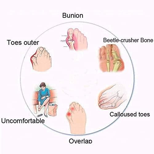 Generic Orthotic Flip Flops for Women, Plantar Fasciitis Sandals for Flat Feet with Arch Support Thong Style Flip Flops Sandals for Comfortable Walk,Black,39