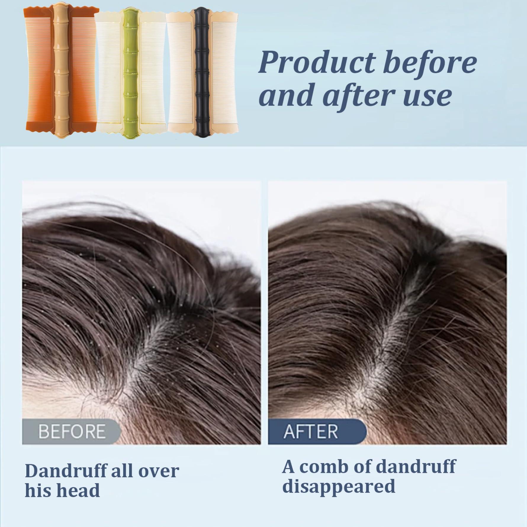 Hibycknl Dandruff Comb 3PCS PP Bamboo Styling Double-Sided Fine Teeth Lice Comb Thick Hair Flea Comb Comfortable Lice Brush 4.9x2.8 Inch Dandruff Comb