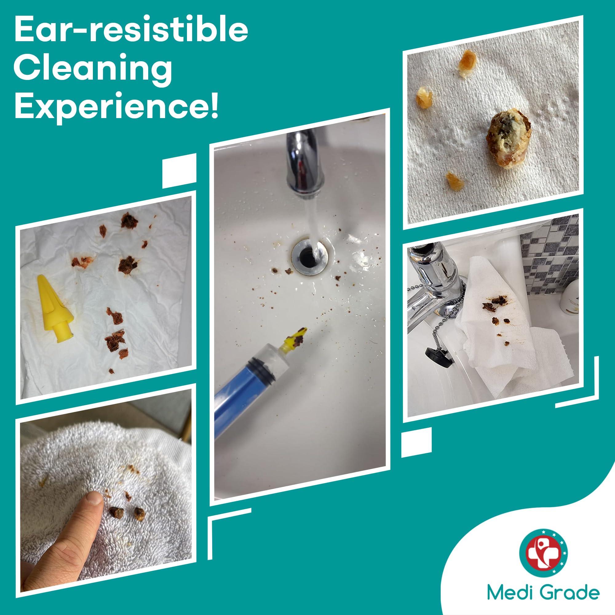 Medi Grade Medi Grade Ear Syringe Ear Wax Removal Kit with 3 Quad-Stream Tips - Ear Irrigation Flushing System - Ear Wax Cleaner to Improve Hearing Clarity and Aural Hygiene - Large Ear Wax Syringe - 2.03 fl oz