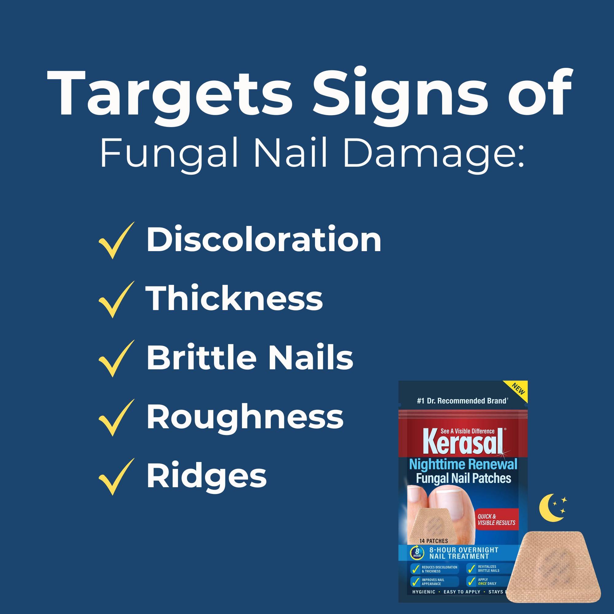 Kerasal Kerasal Nighttime Renewal Fungal Nail Patches - 14 Patch 3 Pack - Overnight Nail Repair for Nail Fungus Damage, 8-Hour Nail Treatment Restores Healthy Appearance