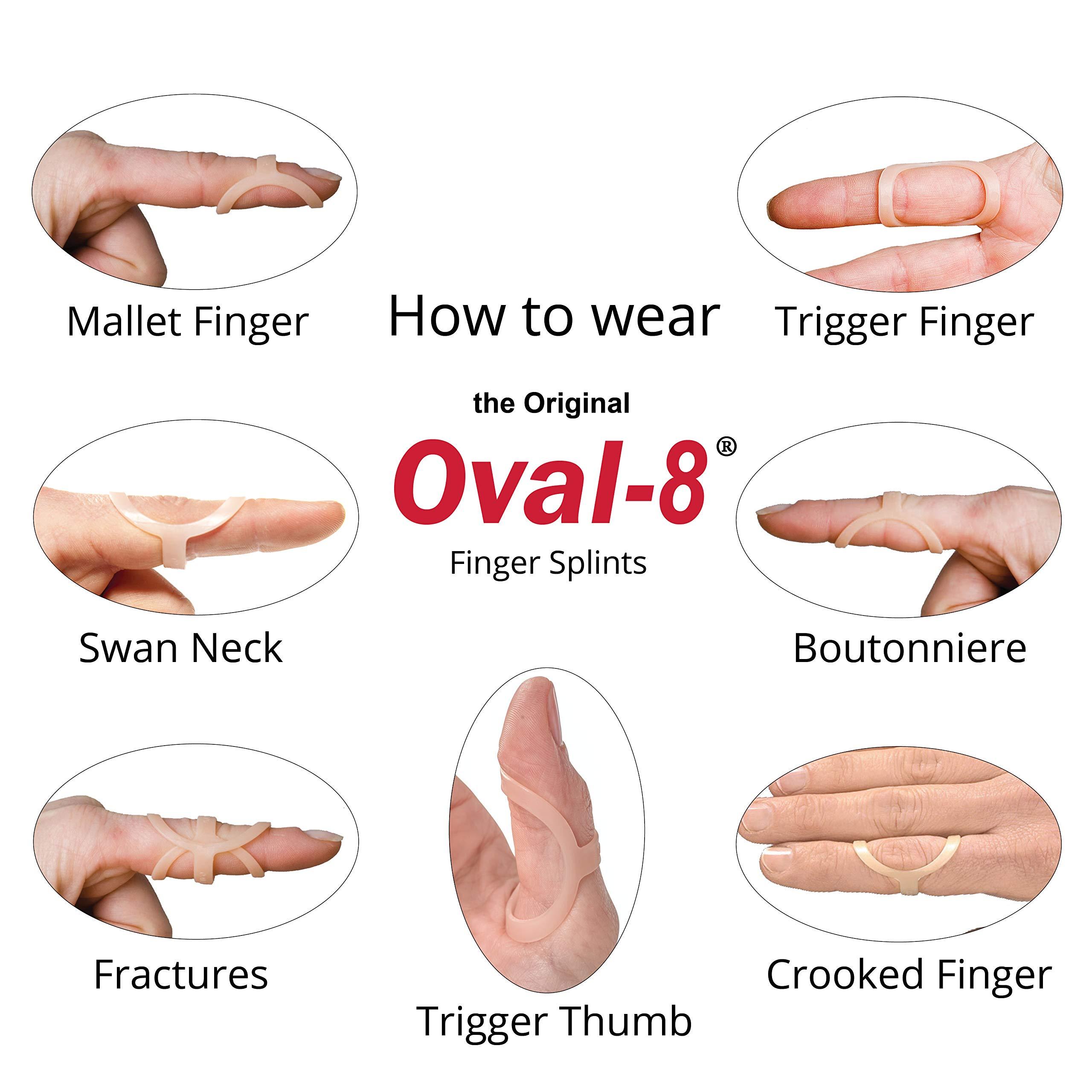 3-Point Products 3-Point Products Oval-8 Finger Splints, Support and Protection for Arthritis, Trigger Finger or Thumb, and Other Finger Conditions Size 8 (Pack of 5)