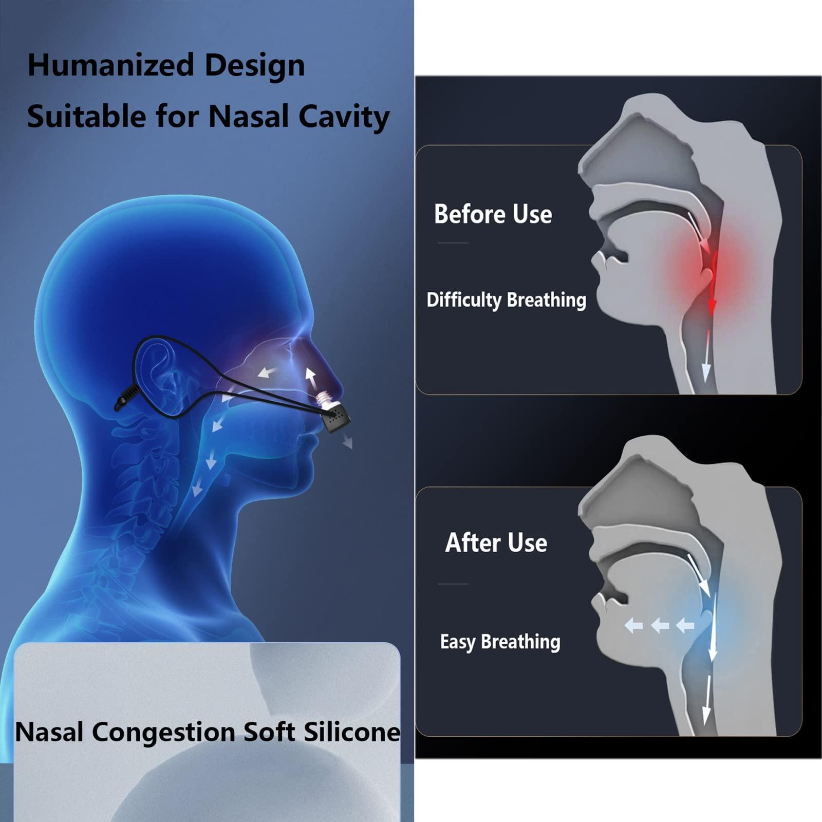 Walkervo Anti Snoring Devices with Fixing Strap Electric Snore Stopper Wearable Anti-snoring Chin Massager 6-Speed Wind Adjustment Stop Snoring Improve Sleep