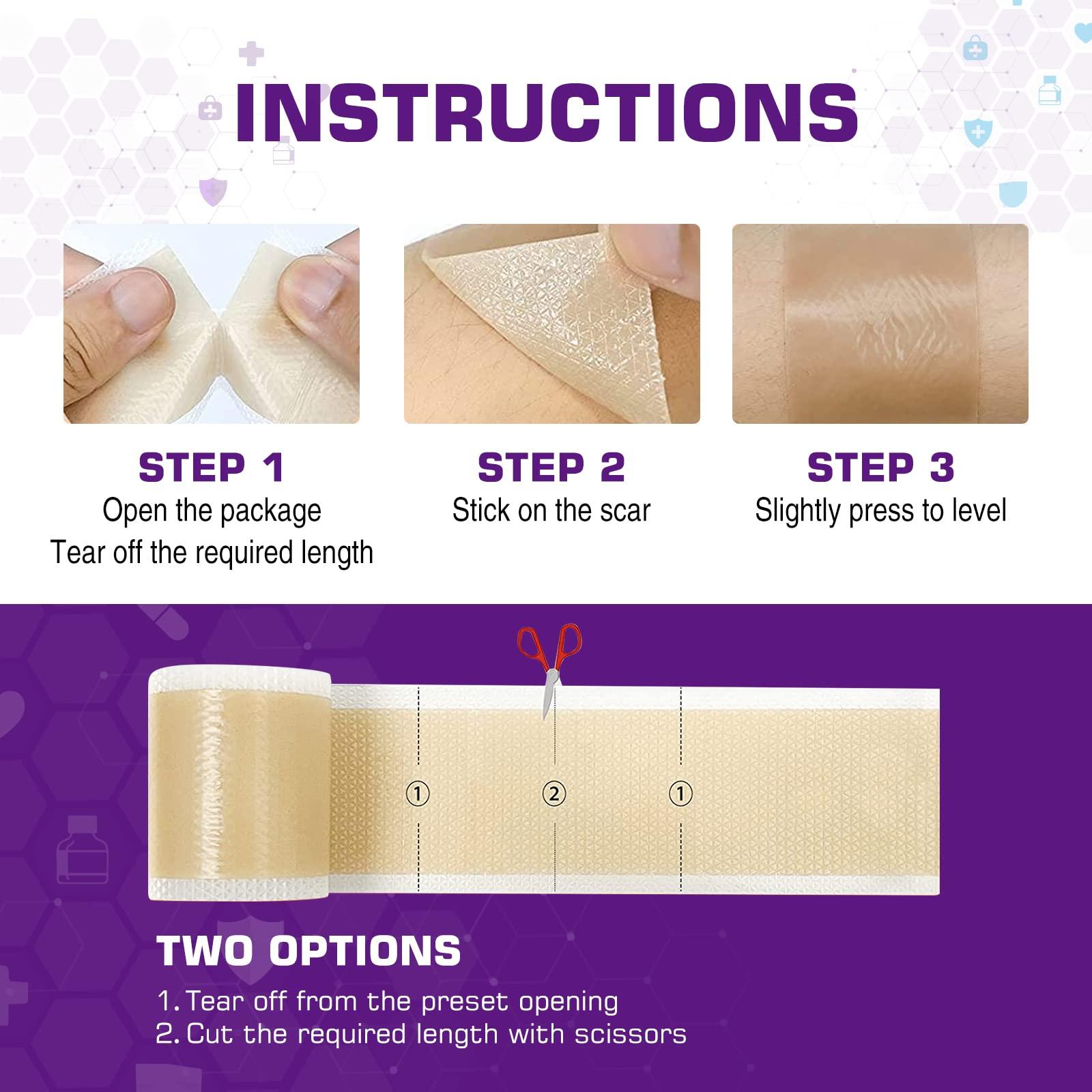 Kelinul Silicone Scar Sheets(1.6\'\' x 60\'\'Roll-1.5M) - Soft Silicone Gel Scar Tape Painless Silicone Tape Roll - Reusable, Medical Grade Silicone Scar Removal Strips for C-Sectio