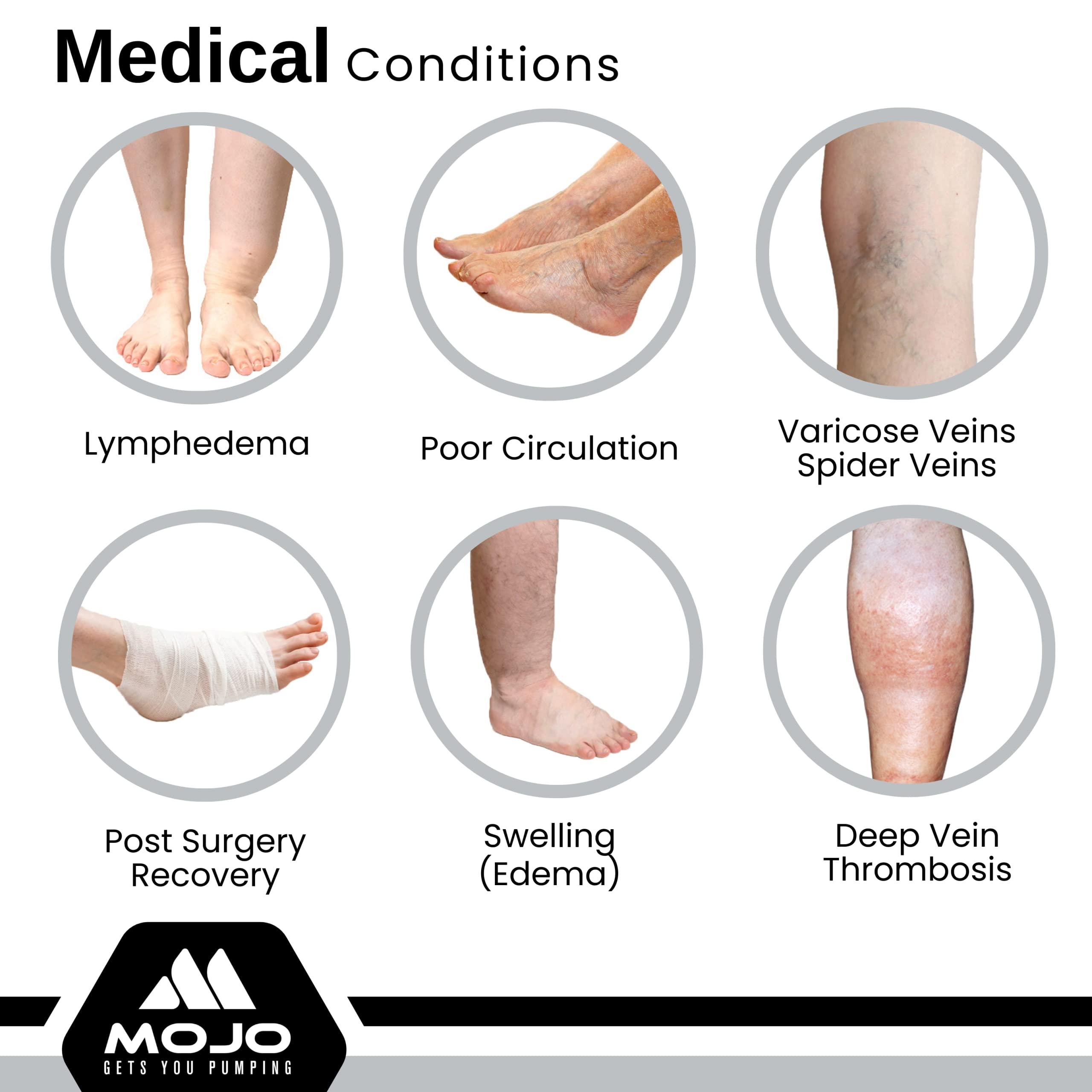 Mojo Compression Socks Compression Socks for Women and Men 20-30 mmHg Wide Calf - Big and Tall Open Toe Compression Stockings for Nursing, Airplane, Varicose Veins Circulation - Brown, 5X-Large - AB211