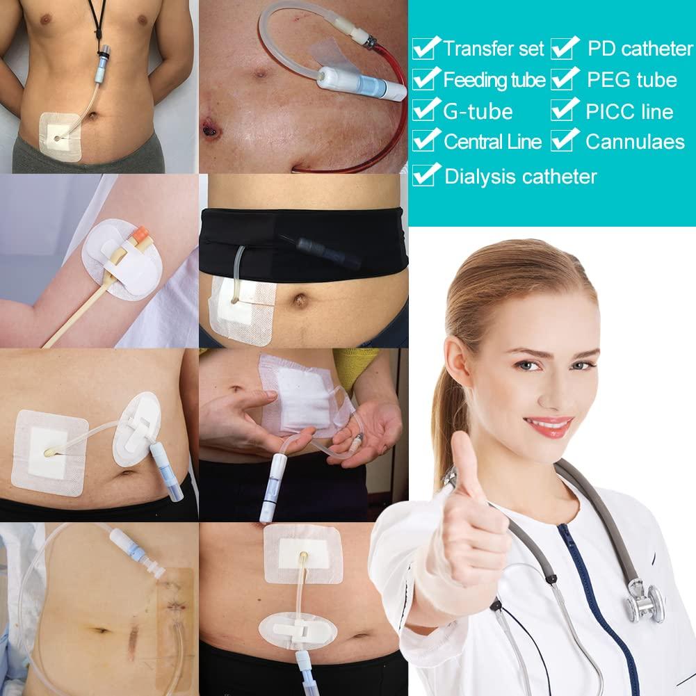 GoToHere Feeding Tube Adhesive Wound Dressing Sponge Split Drain Bandage for Peg G J Supra-Pubic Incision Bordered Guaze Pad Off-Cut Catheter Stabilization Device Holder Post Surgery 4\"X4\", Pack of 20