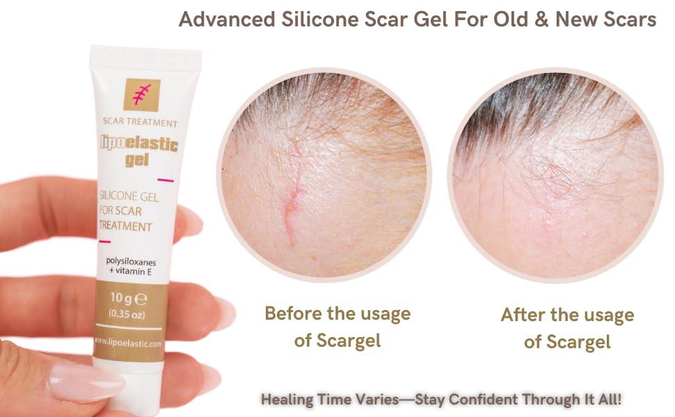 LIPOELASTIC LIPOELASTIC Silicone Scar Cream for Surgical Scars, Medical Grade Silicone Scar Gel with Vitamin E for C-Section, Burn, Stretch Marks, Wound, Old Scar, Acne Scar Treatment, Crema para Cicatrices