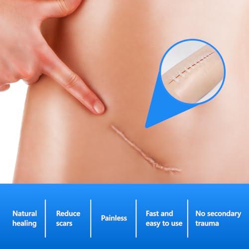 Longmed Longmed Emergency Wound Closures 7.76x2.36 Inch Adhesive Bandages Zip Sutures Butterfly Bandages for C-Section,Keloid, Post Surgery
