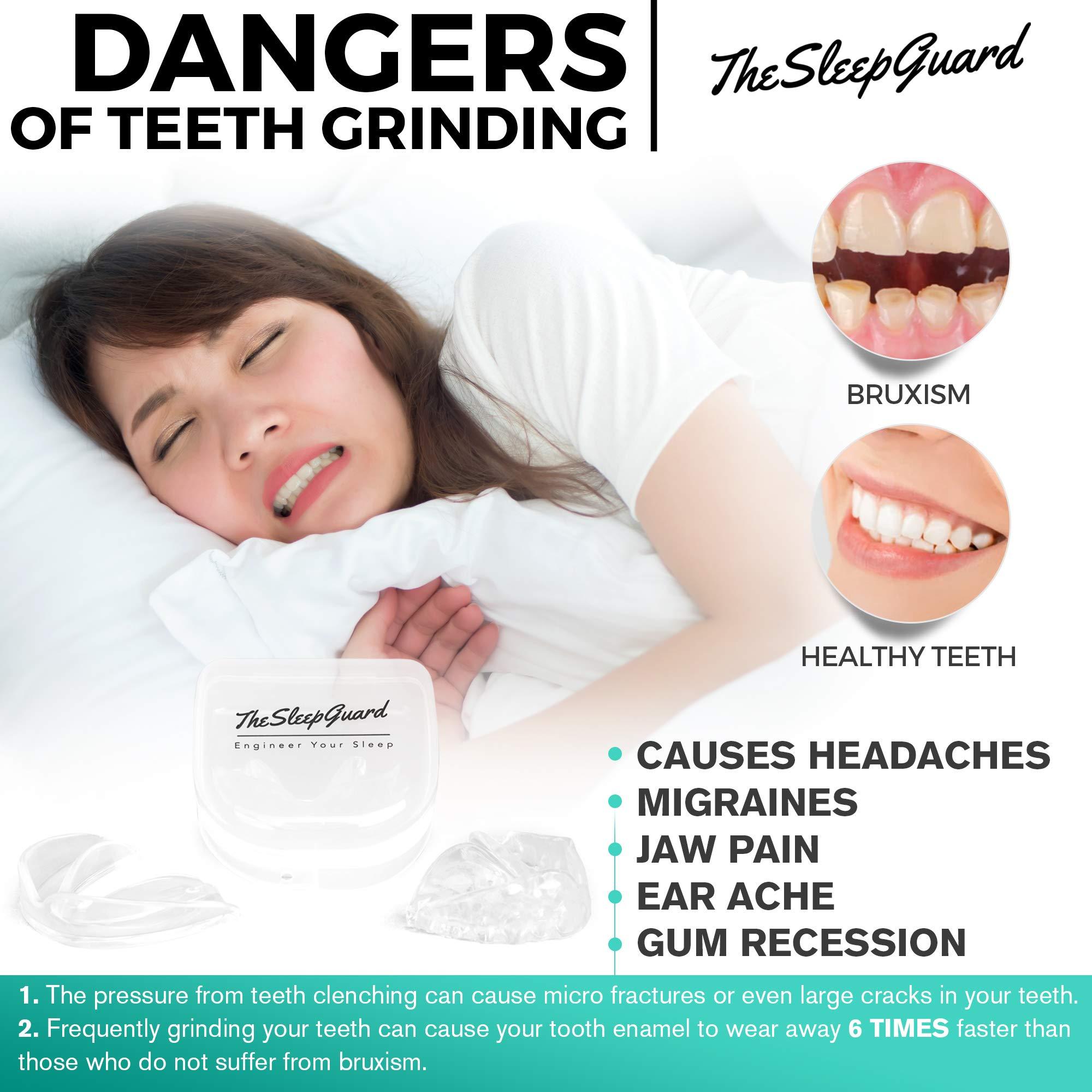 TheSleepGuard TheSleepGuard Mouth Guard for Clenching Teeth at Night [Pack of 4] Best Night Guards for Teeth Grinding, Mouth Guard for Grinding Teeth & TMJ | Night Guard for Men & Women