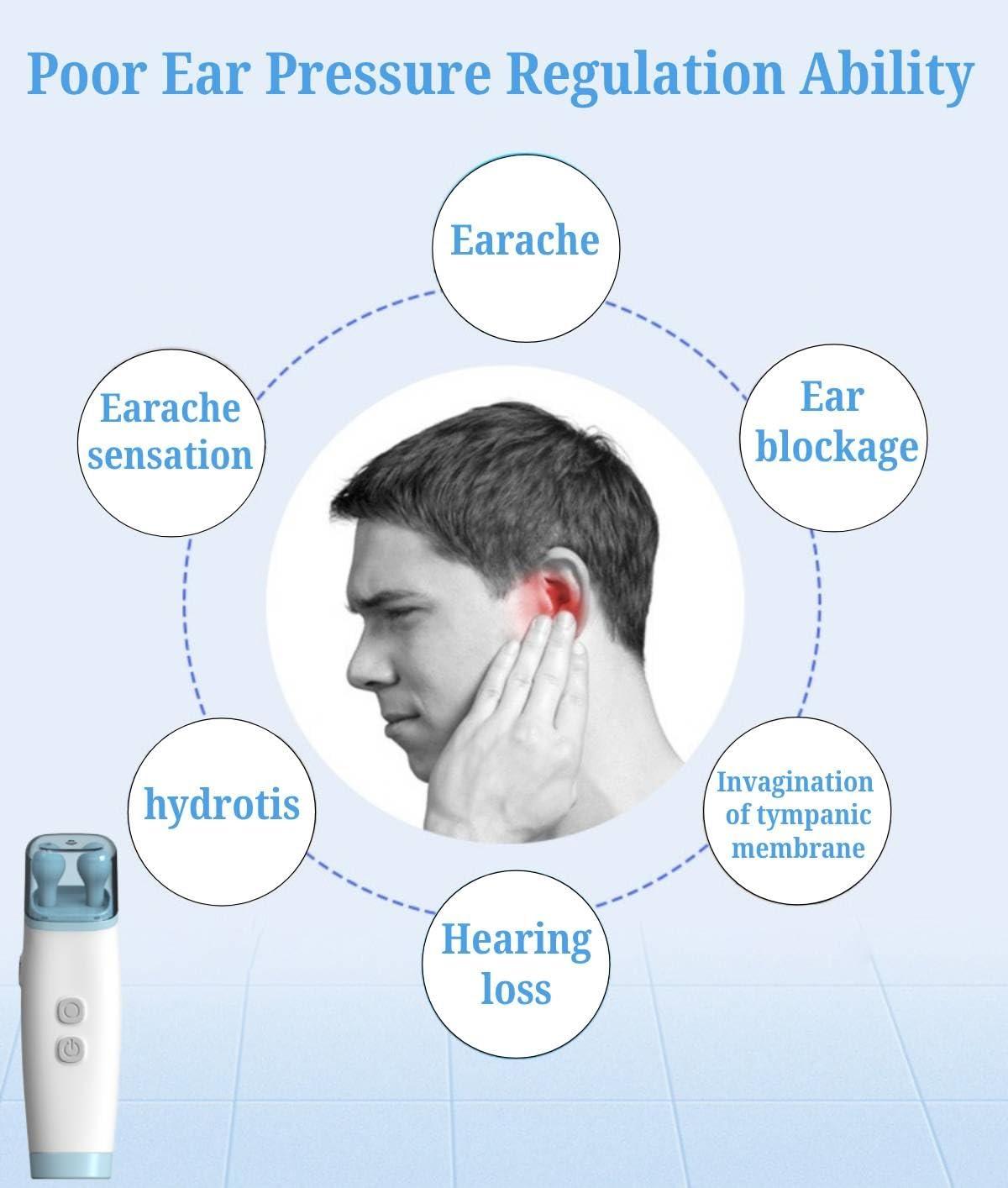 CEPSCS CEPSCS Ear Pressure Relief Device, Balanced Ear Pressure Expander, Tinnitus, Earache, Maintains Ear Pressure Balance to Improve Hearing, Relieve Tinnitus and Ear Pain, White