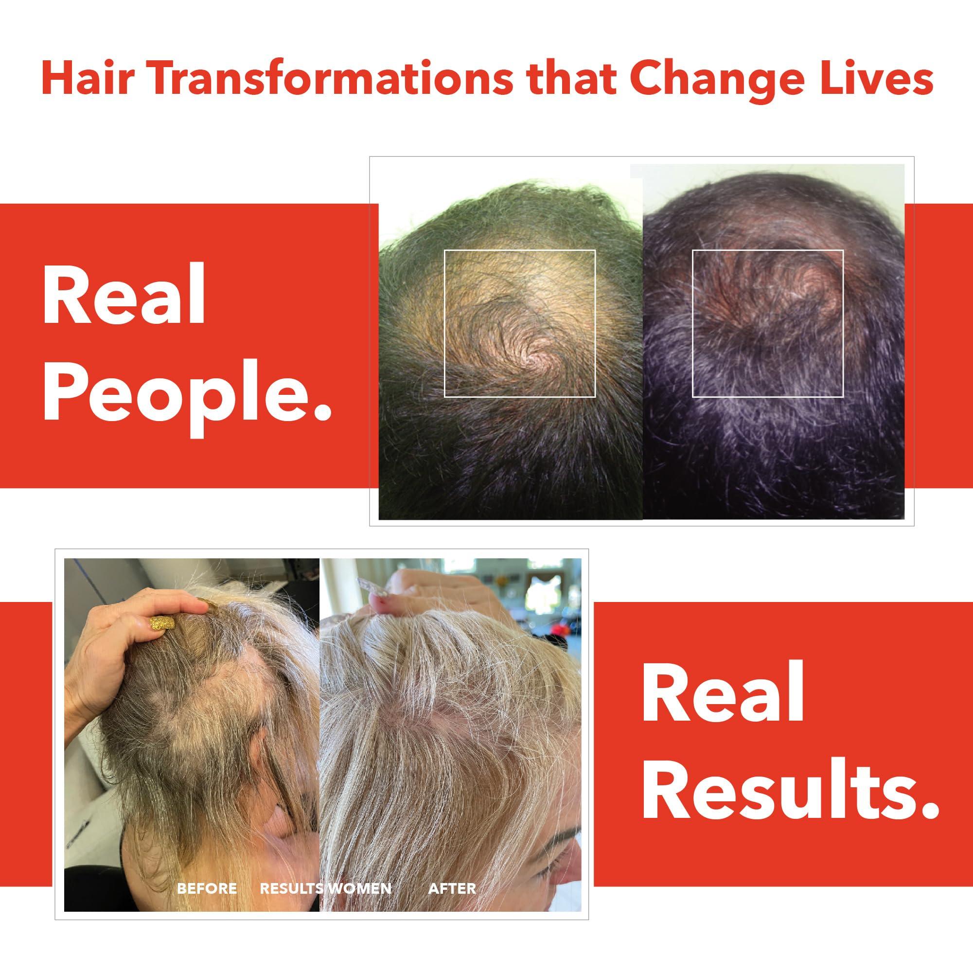 HairSmart HairSmart H5 Grow+ Hair Vitamin Supplement  Biotin, Ayurvedic Herbs & 5 Nutrient Groups for Hair Growth, Density & Strength | Best Hair Growth Supplement for Men and Women