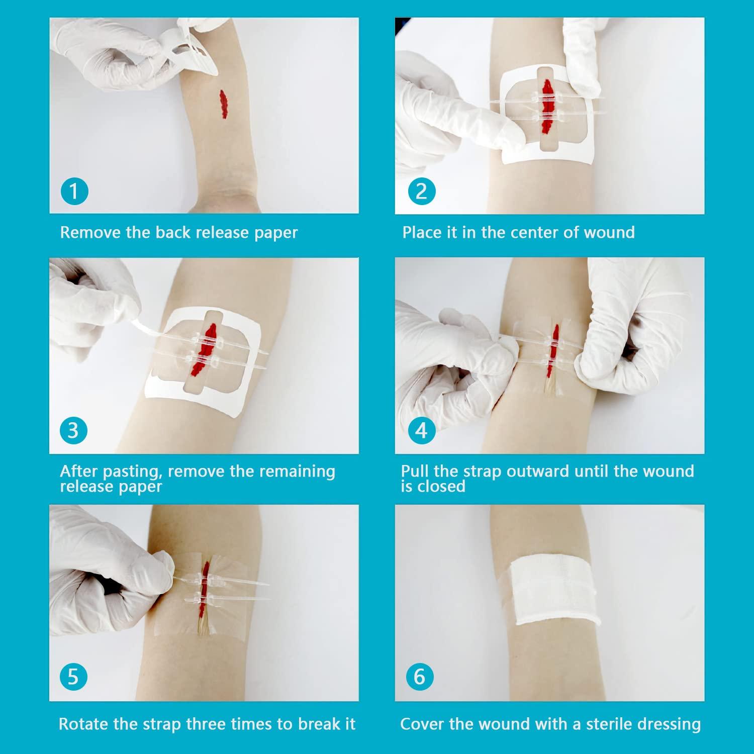 Greetmed Greetmed Zip Stitch Sutures Butterfly Bandaids 4 Pcs Zip Stitches for Wounds Care Laceration Closure Kit Zipstitch Bandages Quick Clot Emergency Zipstitch Wound Closure Device