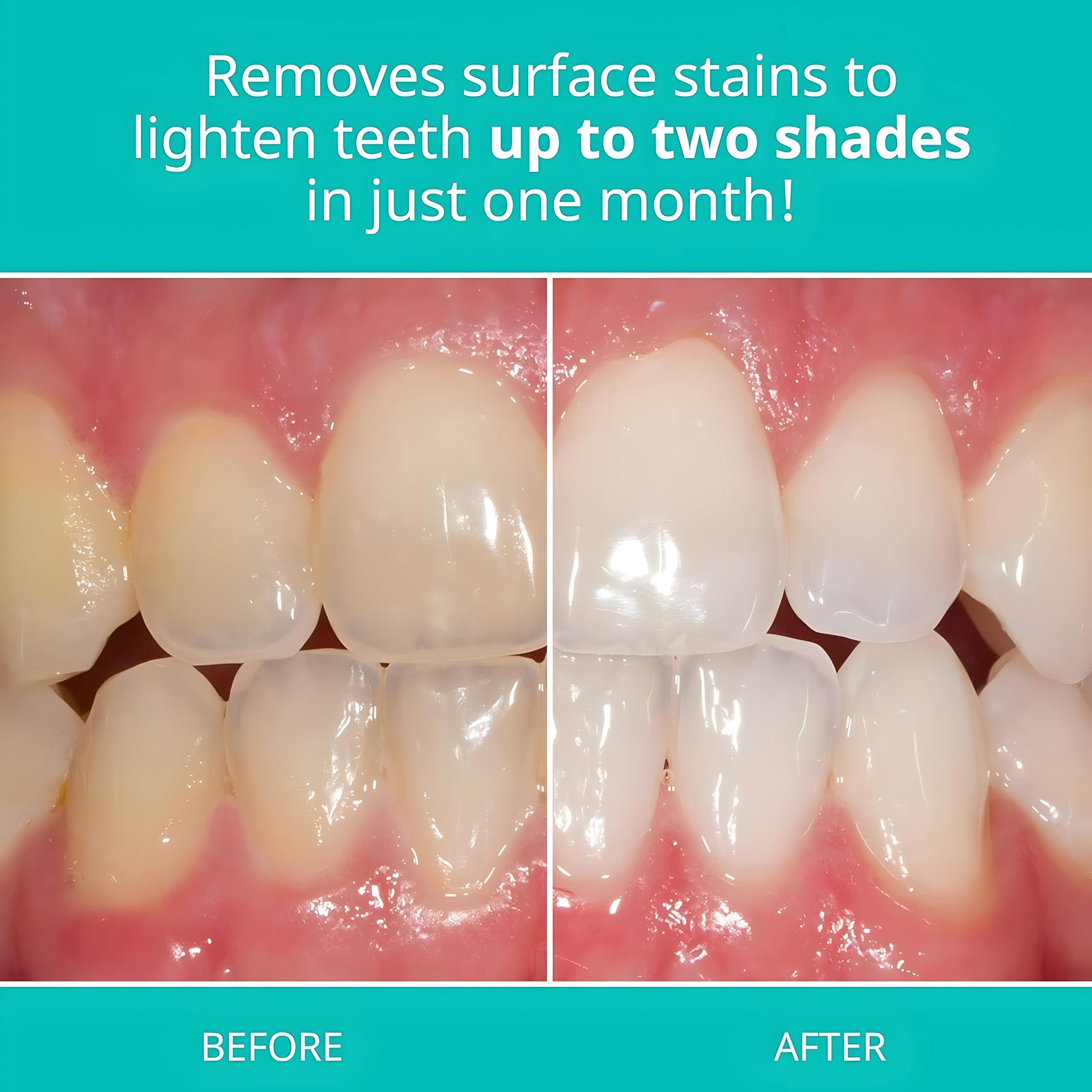 Opalescence Opalescence Whitening Toothpaste Travel Size 1 Ounce (2 Pack) Fluoride Teeth Whitening Toothpaste, Mint Flavor 402-2