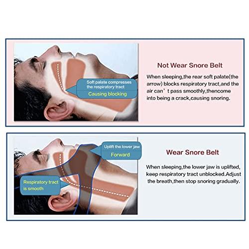 Mrisata Cpap Chin Strap 1382 Chin Strap Anti Snore Belt Apnea Jaw Support Solution Sleep