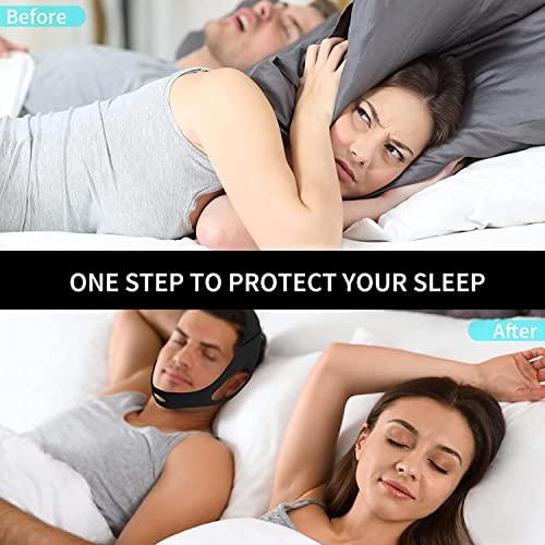 Babyfond Anti Snoring Chin Strap for Men and Women, Comfortable Chin Strap for Cpap Users, Adjustable Stop Snoring Chin Strap Snoring Solution Chin Straps to Keep Mouth Closed While Sleeping (Black)
