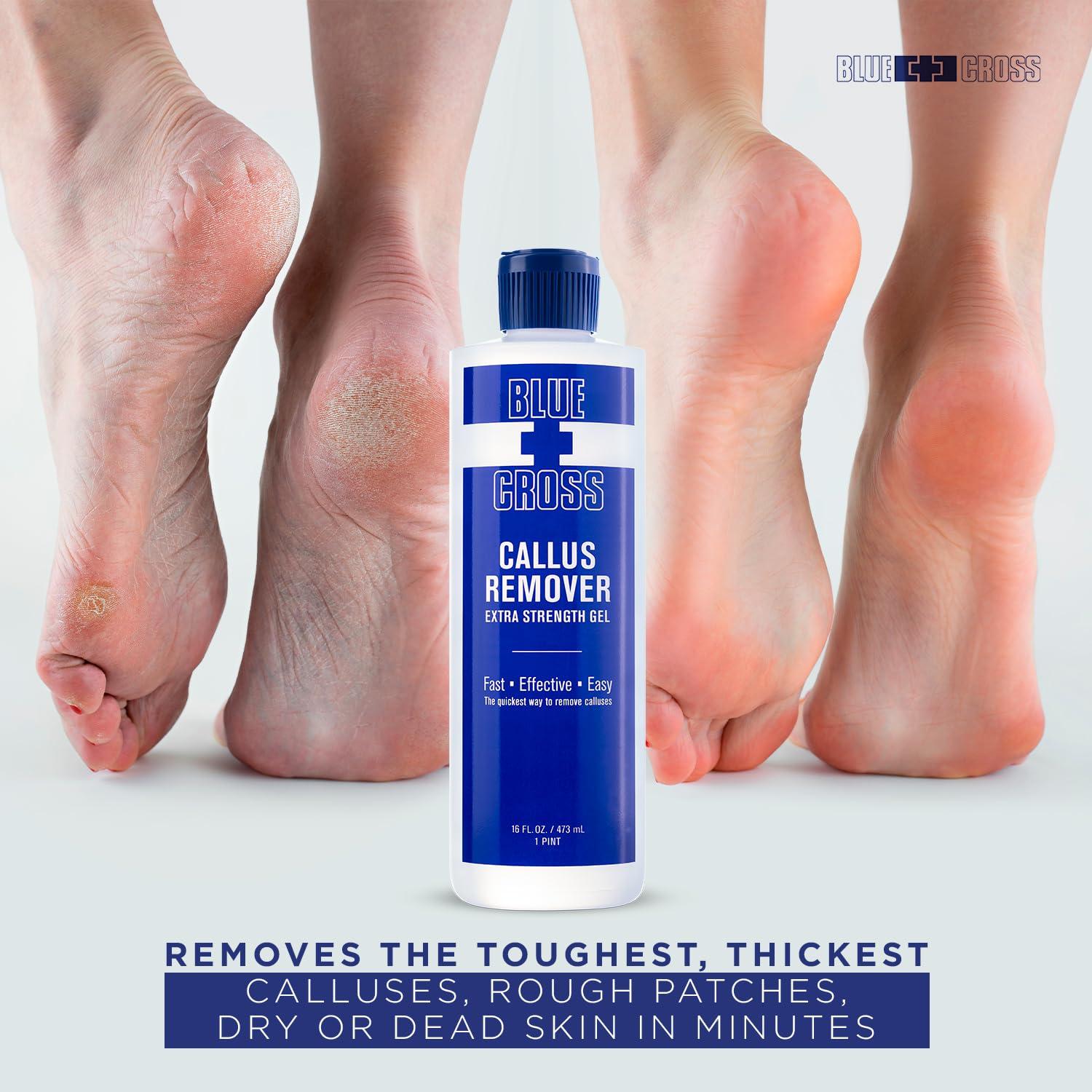 Blue Cross Blue Cross Callus Remover Gel for Feet or Heel, Extra Strength Professional Nail Care, File, Shaver, Scrubber & Pumice Stone Alternative for at Home Manicure/Pedicure Results, 16oz