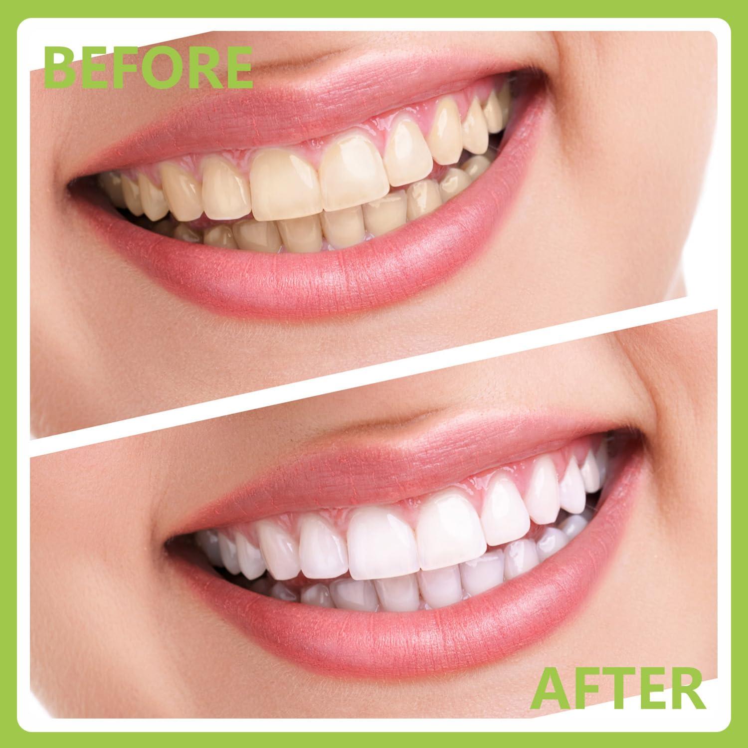 PARYUNGR PARYUNGR Dental Tools, Professional Teeth Cleaning Oral Care Hygiene Kit, Stainless Steel Dental Pick Tooth Scraper Tartar Plaque Remover for Dentist, Personal, Pet Use with Storage Box