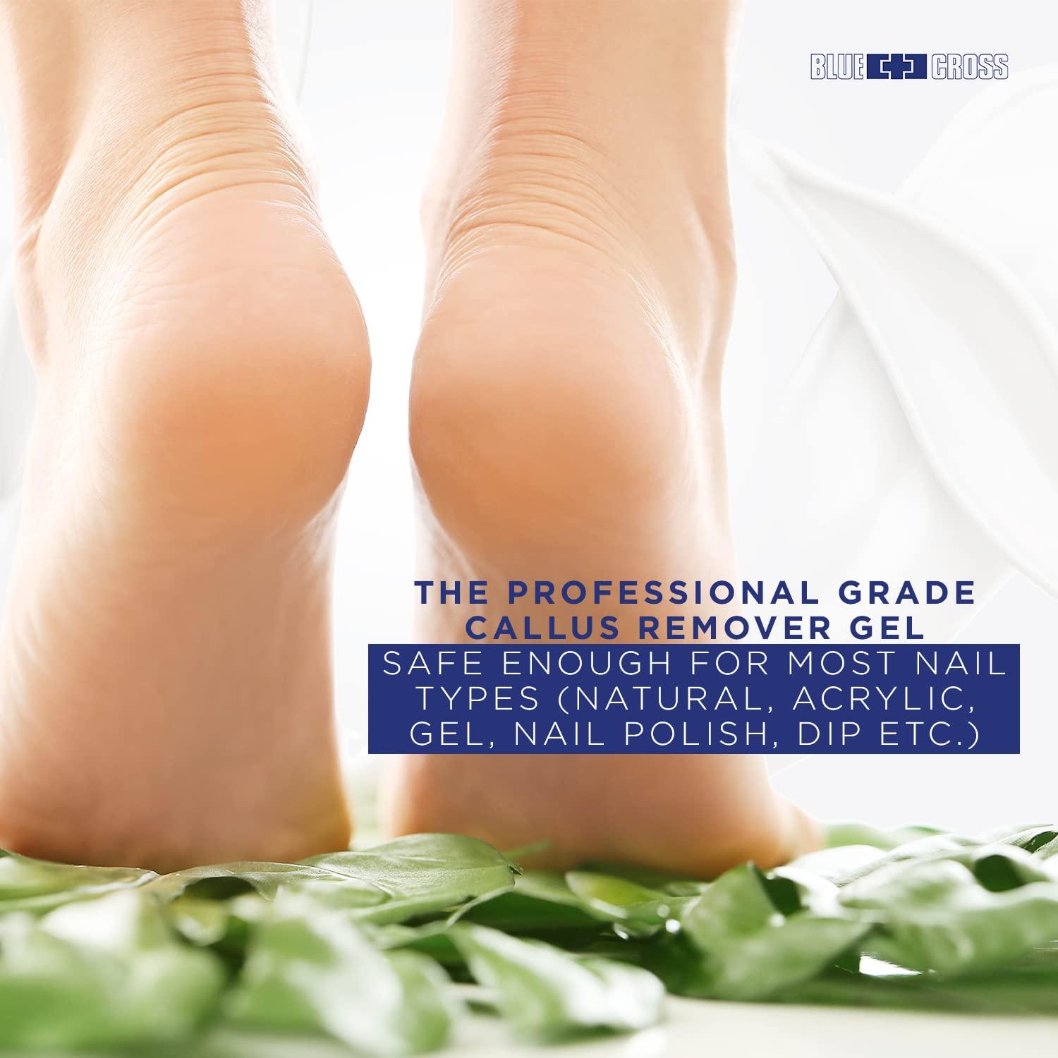 Blue Cross Blue Cross Callus Remover Gel for Feet or Heel, Extra Strength Professional Nail Care, File, Shaver, Scrubber & Pumice Stone Alternative for at Home Manicure/Pedicure Results, 6oz