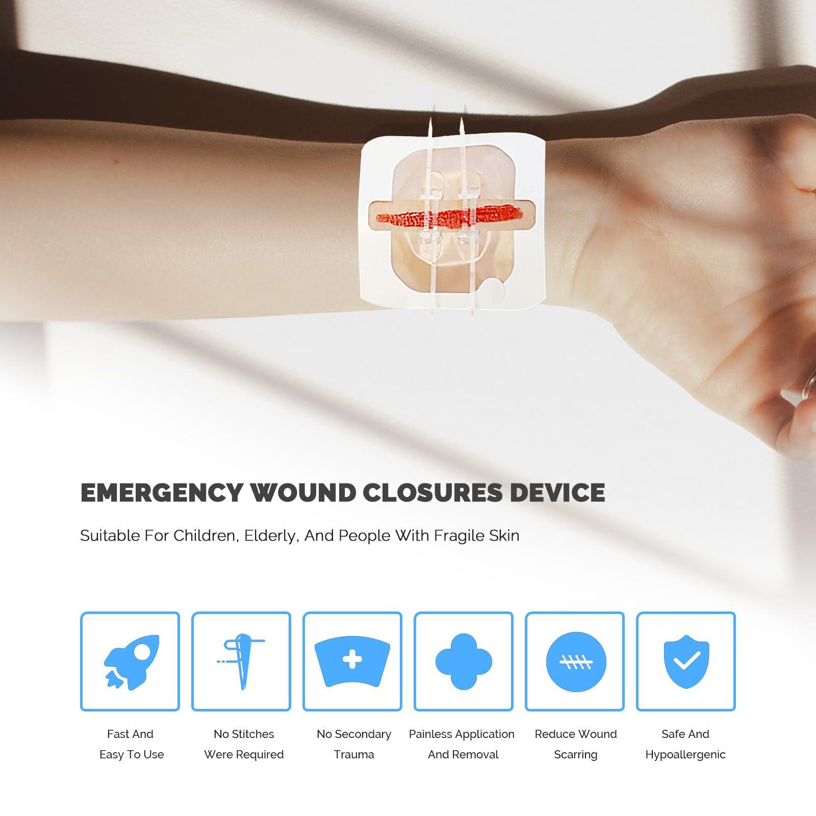 Greetmed Greetmed Zip Stitch Sutures Butterfly Bandaids 4 Pcs Zip Stitches for Wounds Care Laceration Closure Kit Zipstitch Bandages Quick Clot Emergency Zipstitch Wound Closure Device