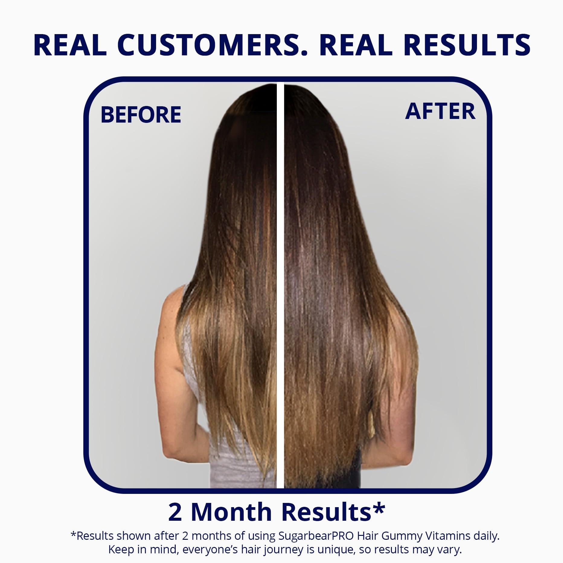 SugarBearHair Sugarbear Hair Vitamin Gummy 2 Month Supply Extra Strength Biotin 6000mcg, Growth for Men & Women, Vegan Vitamin B12, MSM, Inositol, Omega 3, Elderberry, Certified Kosher, Halal, Cruelty-Free