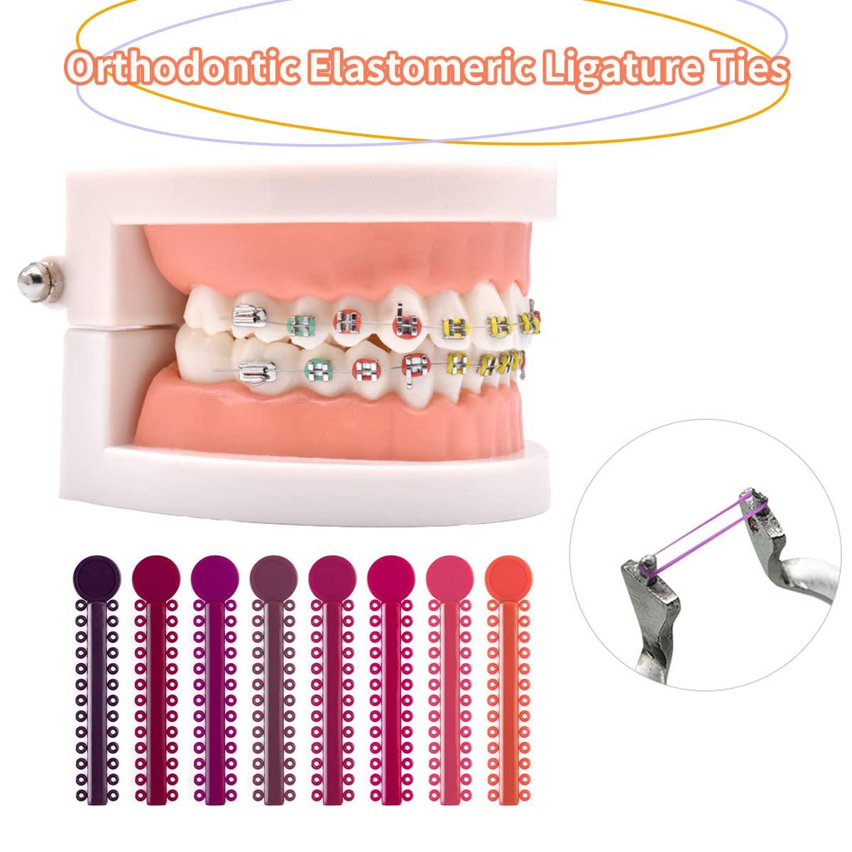 Ceonam 1040 Pcs Multicolored Braces Rubber Bands Orthodontic Ligature Ties O-Rings Elastic Bands for Braces (Color)