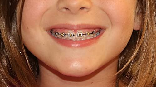 Snapcaps Snapcaps Braces Bumper Cover, Orthodontic Bracket Wax Substitute, Alternative Snap-on Braces Guard Braces Accessories 10 pack (Cross)