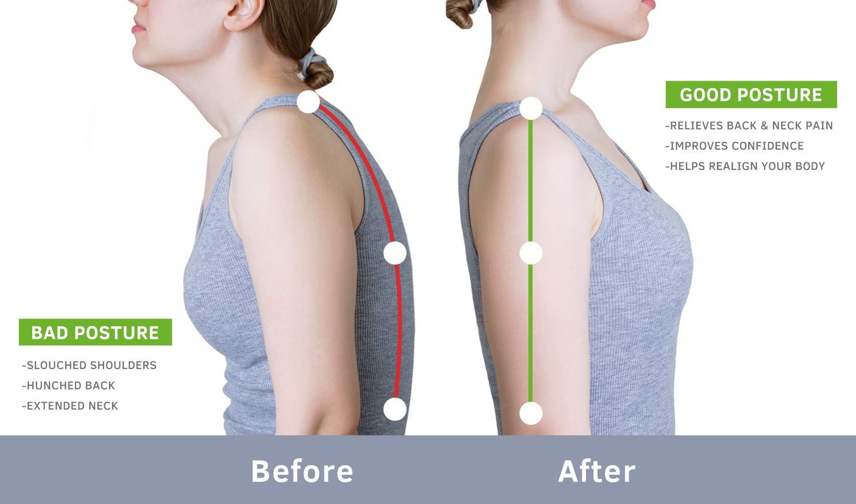 BEIBYE BEIBYE- Upper Back and Headache Pain Relief - treatment for Costochondritis and Tietze Syndromeb-Help Back Stretcher, Posture Corrector