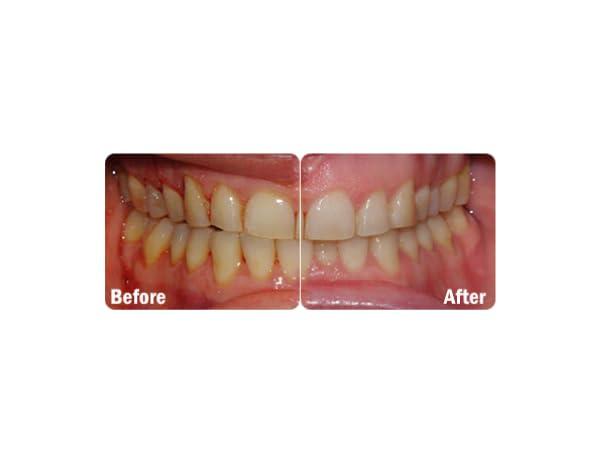 ProBiora Health ProBiora Oral-Care Chewable Probiotic Tablets | Probiotic Supplement for Women & Men | Healthier Teeth & Gums | Fresher Breath | Whiter Teeth | Better Overall Health | 30 Count | Pack of 3 | Mint