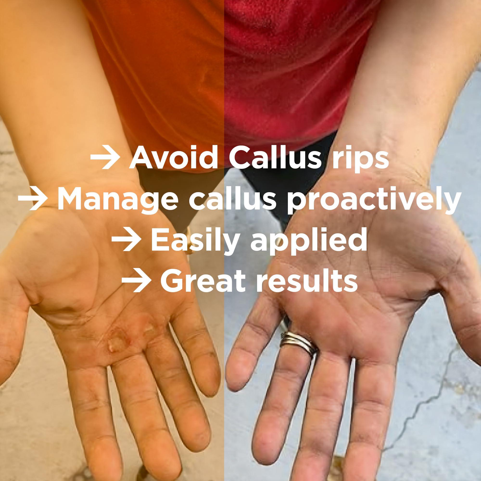 Callus Performance Proactive and Reactive Hand Callus Shaver | Callus Remover for Hands and Athletes Doing Weights or Crossfit Training | Ultra Precision Callus File/Tool with 2 Extra Smoothing Callus Sanding Discs