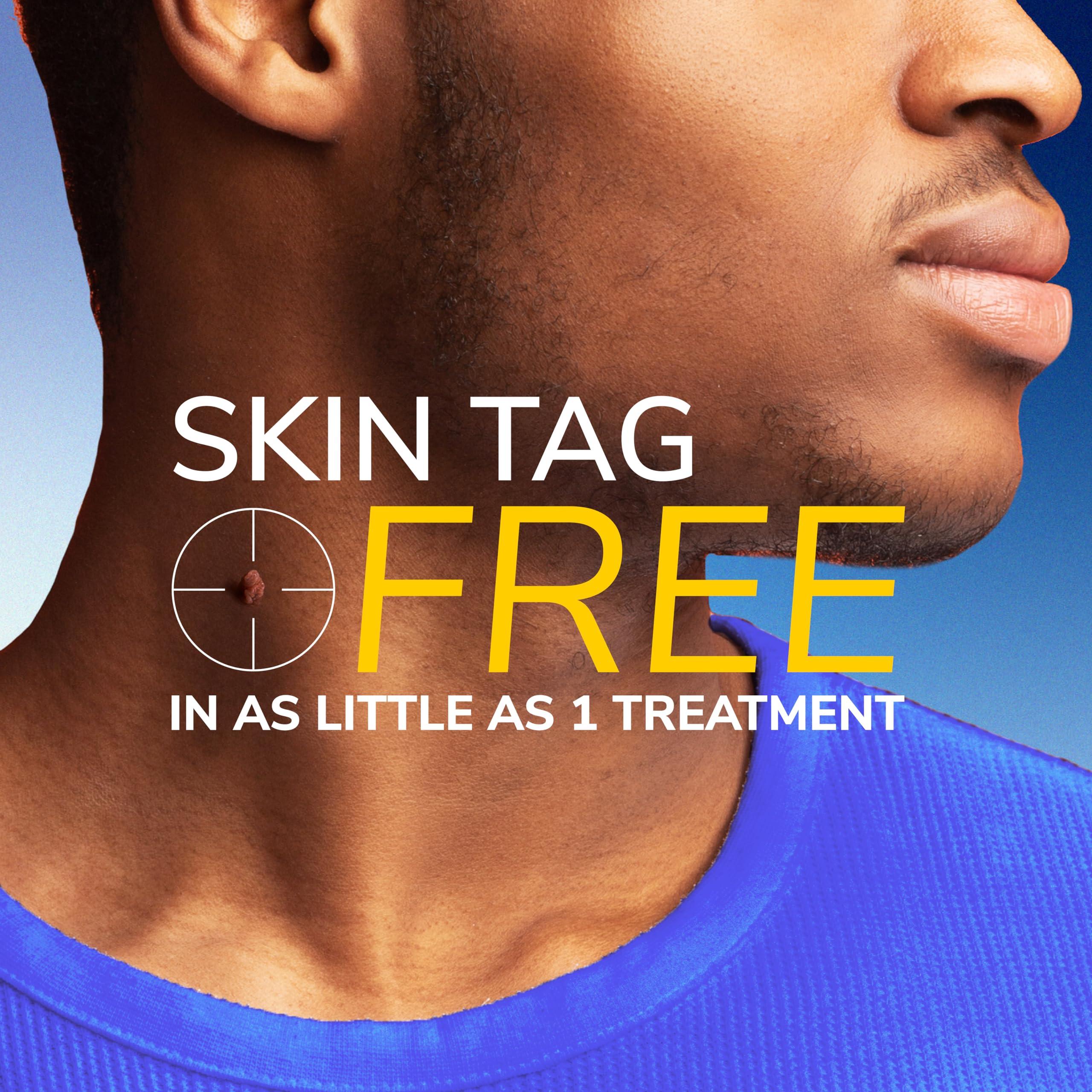 Dr. Scholl's Dr. Scholl's Freeze Away Skin Tag Remover - The First FDA Cleared, at Home Skin tag Removal kit. Clinically Proven Skin tag Removal in as Little as 1 Treatment. 1 Skin tag Removal kit, 8 Treatments.