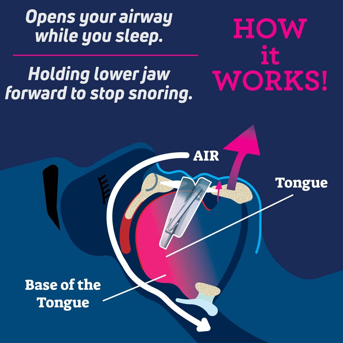 SmartGuard SmartGuard Anti Snore Device. New Customizable Snore Reducing Mouthpiece Reduce Snoring Aid for Men and Women Most Comfortable and Adjustable Oral Appliance - Holds Jaw Forward to Open Airway