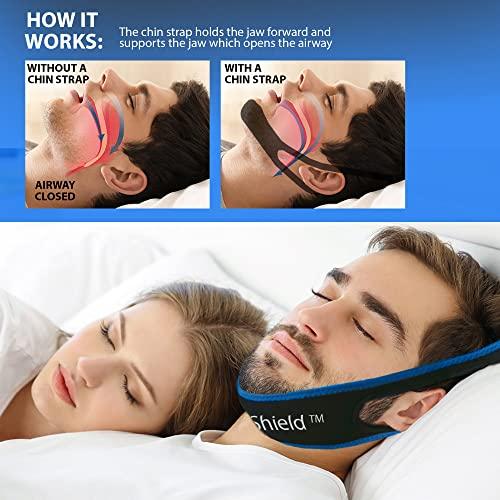 SnoreShield(TM) SnoreShield Anti Snore Chin Strap - The #1 Ranked Snoring Sleep Solution - Natural And Comfortable Instant Snore Stopper - Easy To Use And Adjustable