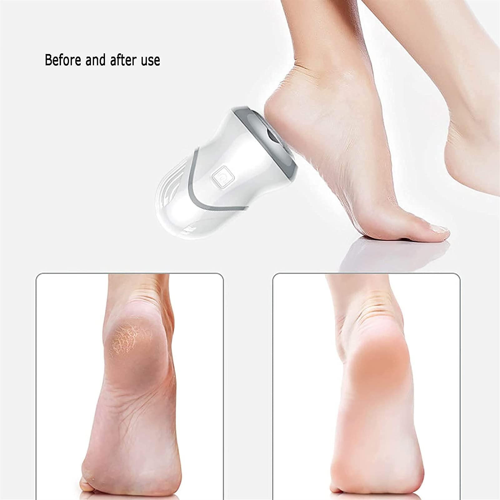 GIENEX GIENEX Electric Callus Remover for Feet, Foot Callus Remover, Rechargeable Vacuum Foot Grinder, Pedicure Foot File Callus Remover