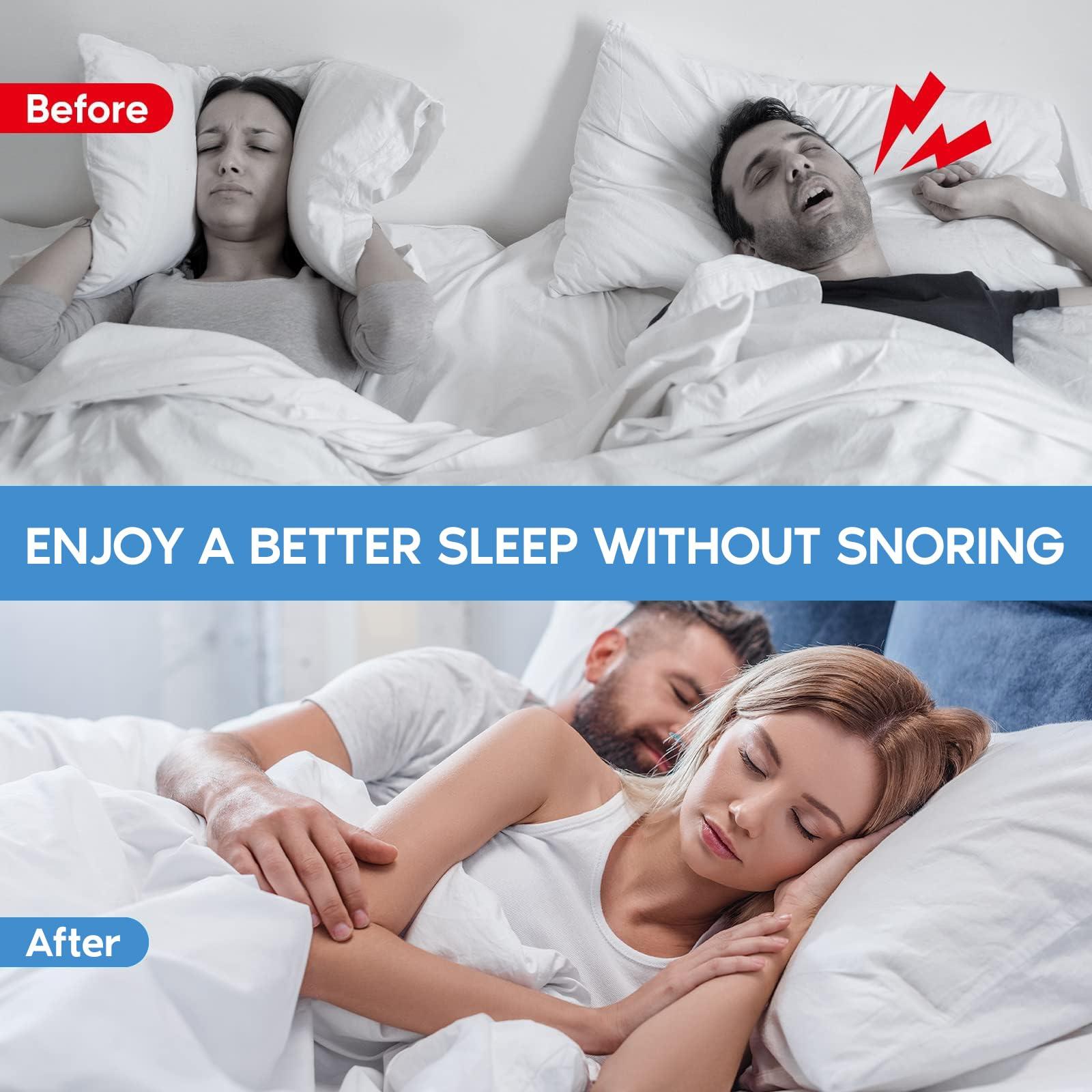 KinomiYa KinomiYa 8pcs Anti Snoring Nose Vents Device That Work, Anti Nose Vents for Snoring Devices, Snoring Devices for Men, Nose Opener for Breathing Sleep, Stop Snoring Devices That Work for Men
