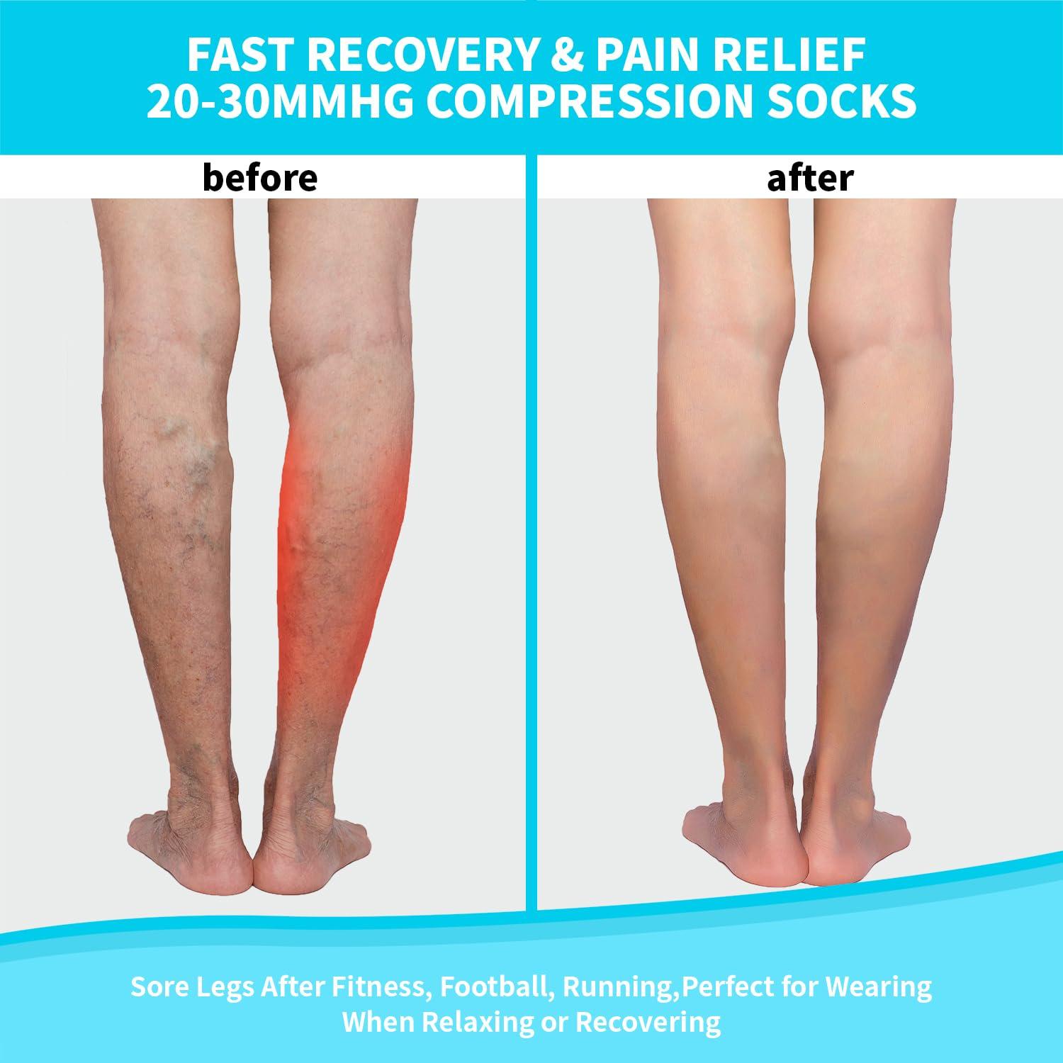 TZYSOKC Open Toe Compression Socks 15-20 mmHg for Women and Men Knee High Toeless Circulation Compression Stockings(B 2XL)