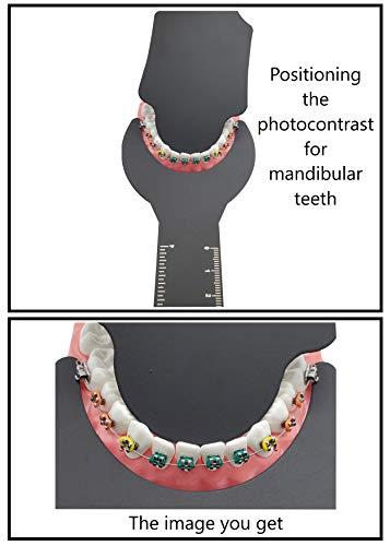 Artman Instruments Photographic Black Contraster 6 pcs in Cassette Autoclavable Dental Orthodontic Oral Cheek retractors Photographic Black Background Backdrop ARTMAN Brand