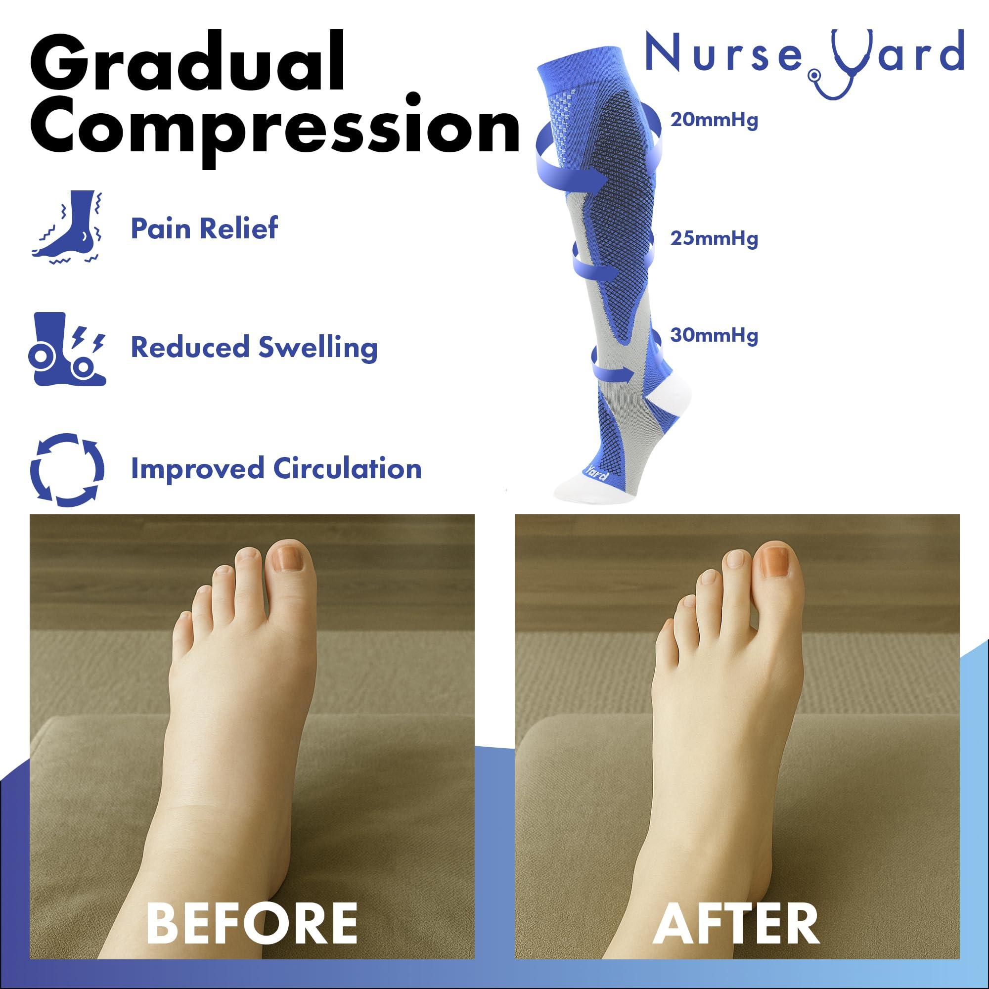 Nurse Yard Nurse Yard Compression Socks for Nurses - Women & Men - 20-30mmHg Graduated Compression, Zero-Toe Compression, For Medical Staff, Nursing, Athletic Support Such As Running, Cycling, Hiking - 1 Pair