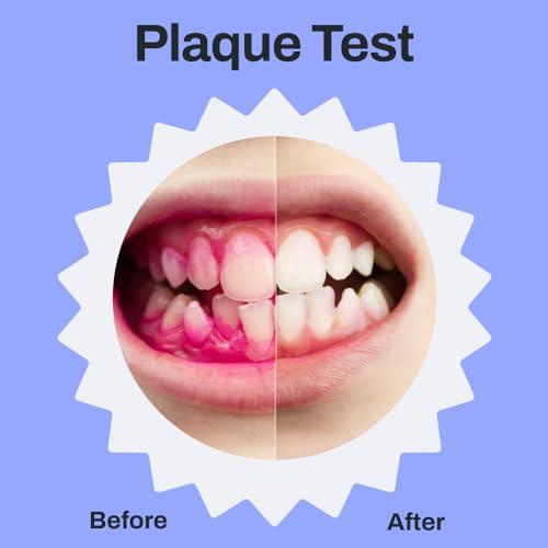 autobrush autobrush Kids U Shaped Electric Toothbrush, ADA Accepted, Sonic Pro with Unique 360 Nylon Bristles 3 Cleaning Modes,Whitening LED-Lights,Plays Music (Double-Sided),Ages 9-12, Lion