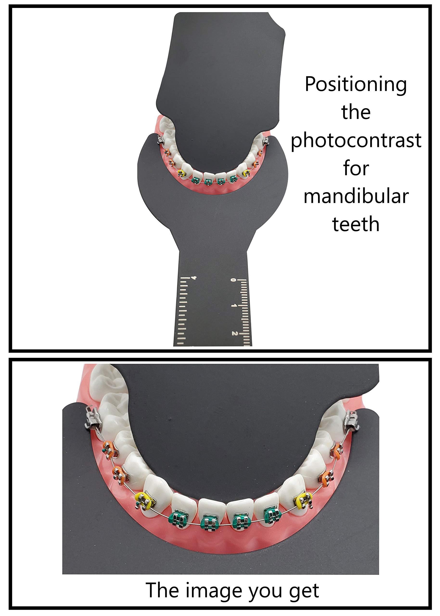 Artman Instruments Photographic Black Contraster 6 pcs in Cassette Autoclavable Dental Orthodontic Oral Cheek retractors Photographic Black Background Backdrop ARTMAN Brand