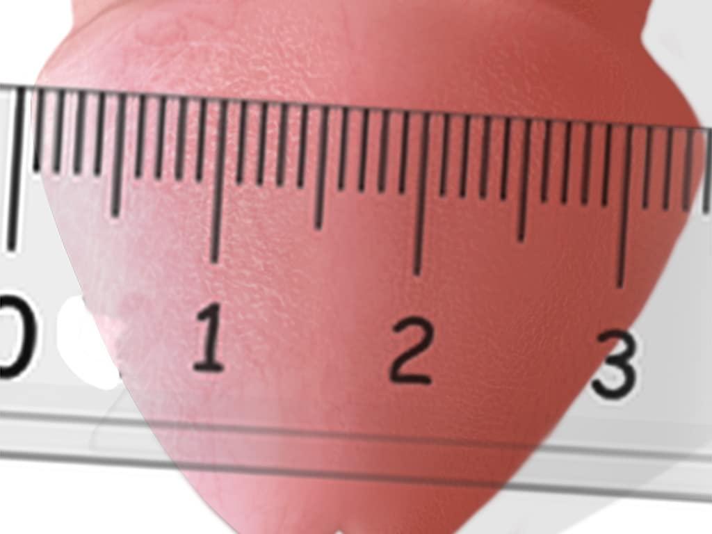 Advanced Devices Supercanister Novice Penile Traction Device Restoration Foreskin (33)