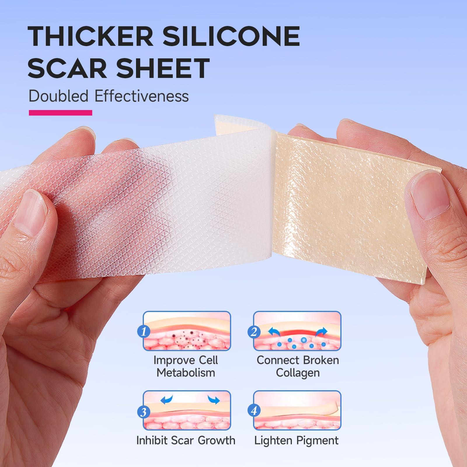 EzonaCare EzonaCare Thicker Silicone Scar Sheets, Medical Grade Silicone Scar Tape Roll (118\" x 16\") Effective, Strong Stickiness, Scar Sheets for Surgical Scars, Keloid, C-Section, Burn, Acne