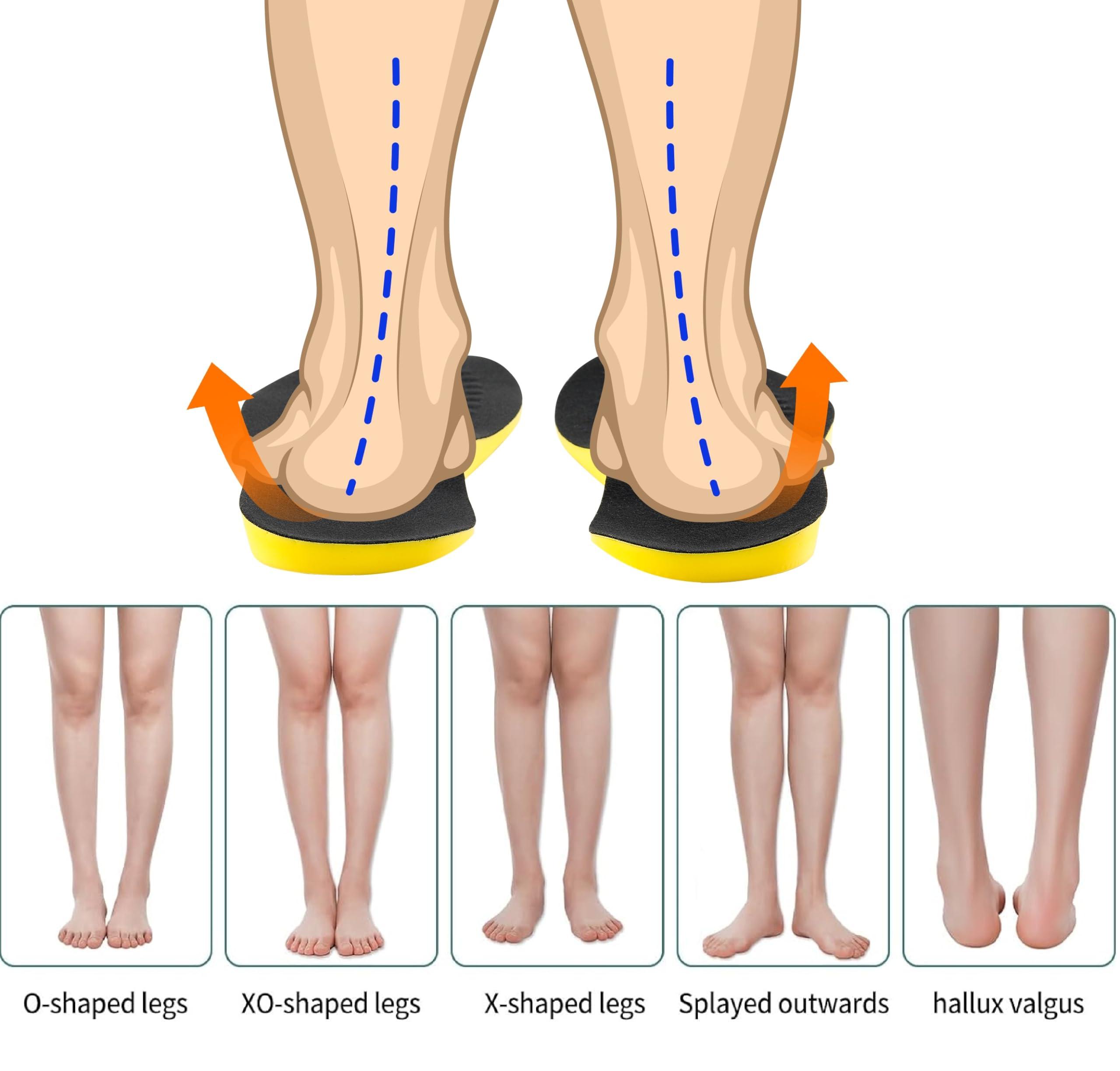 FOXOXI Supination Insoles for Correct Standing Posture,Orthotic Inserts for Men and Women,Heel Wedge Inserts for Bow Legs,Knock-Knees,Foot Alignment (Color : Black, Size :S)