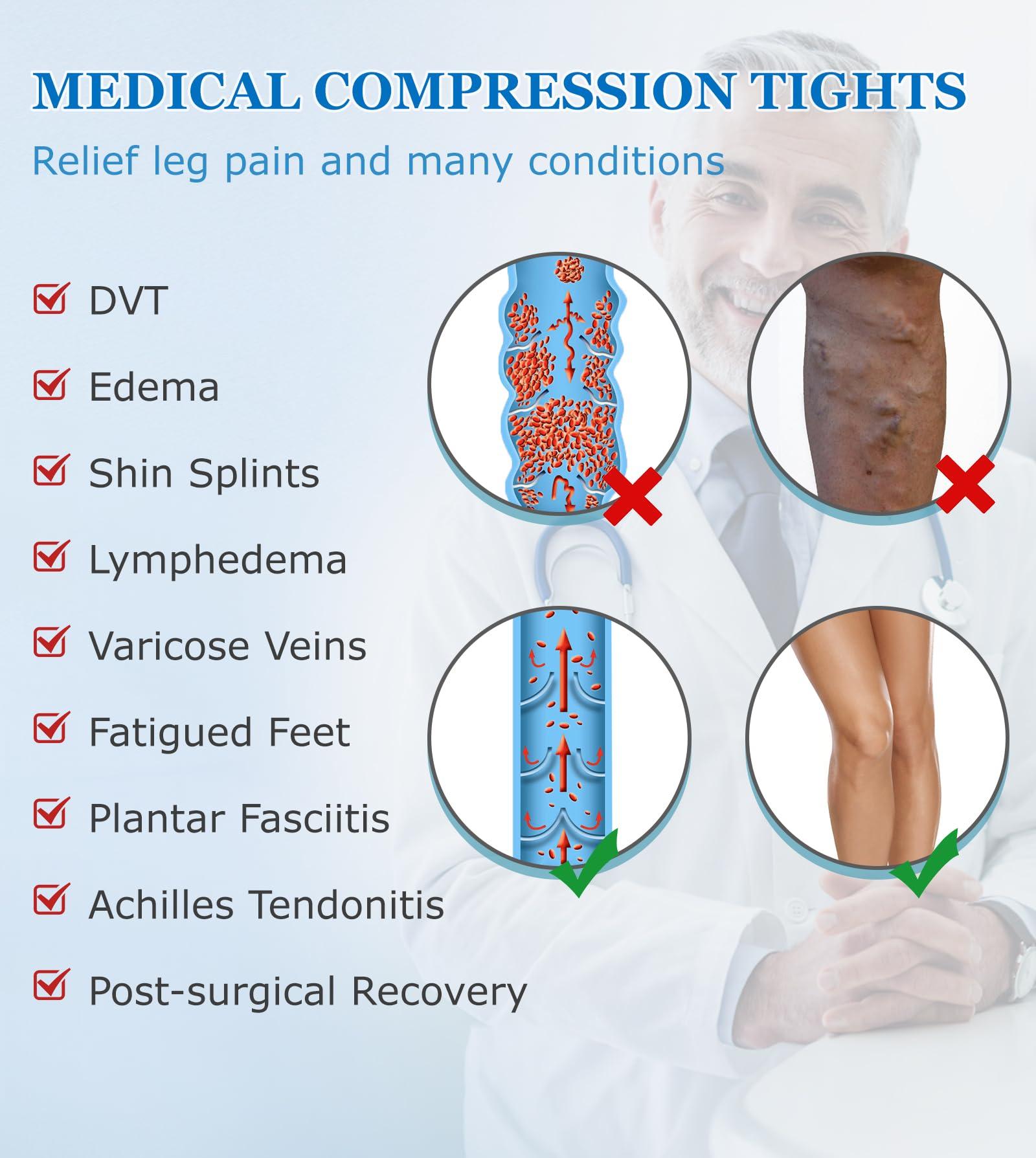 MGANG MGANG Medical Compression Pantyhose for Women & Men, Closed Toe, Opaque, Waist High Compression Circulation Leggings, 15-20 mmHg Firm Support Compression Hose for Varicose Veins, Edema, DVT, Black S