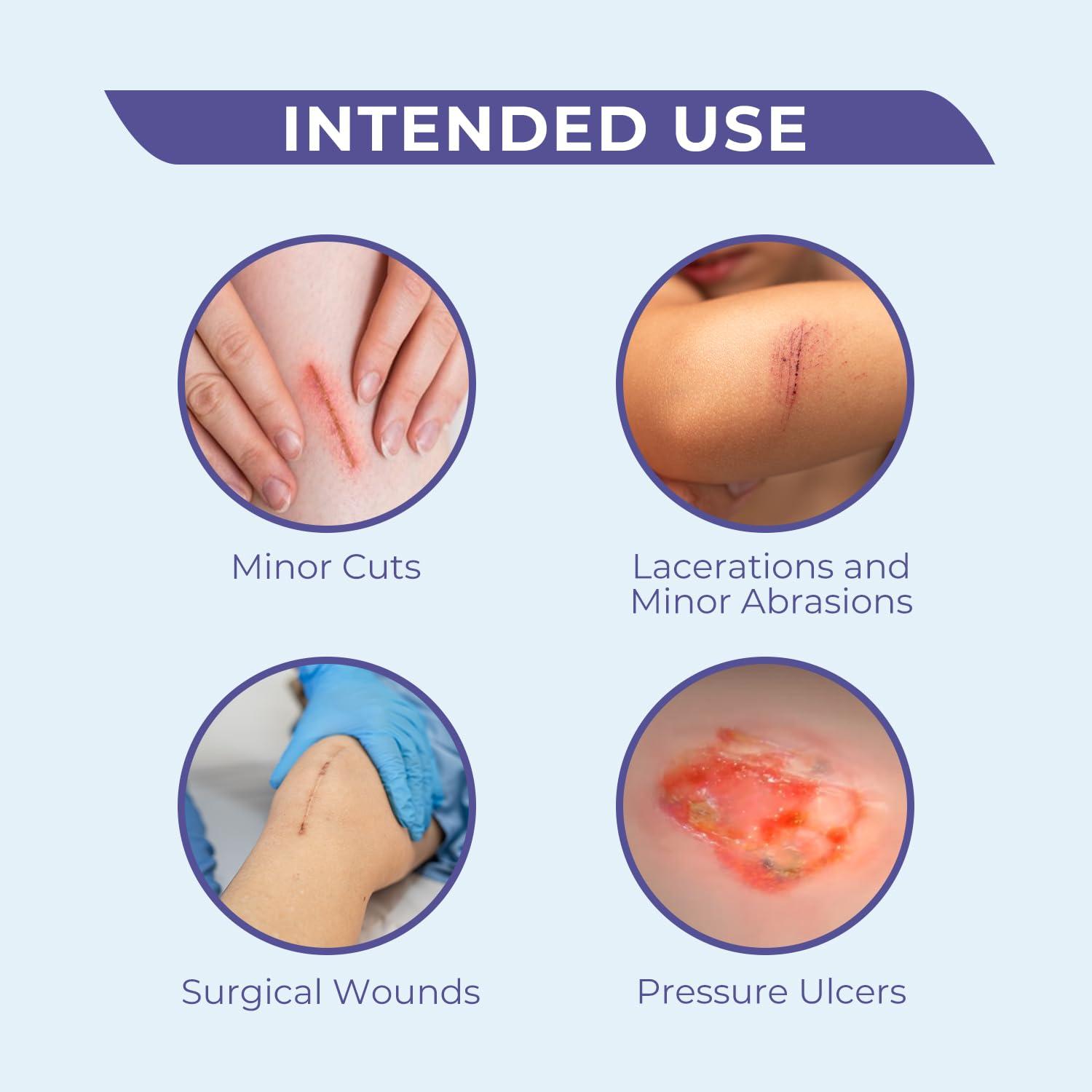 Conkote Conkote Hydrocolloid Wound Dressing 4”x 4”, Sterile Adhesive Patches, Box of 10 Dressings