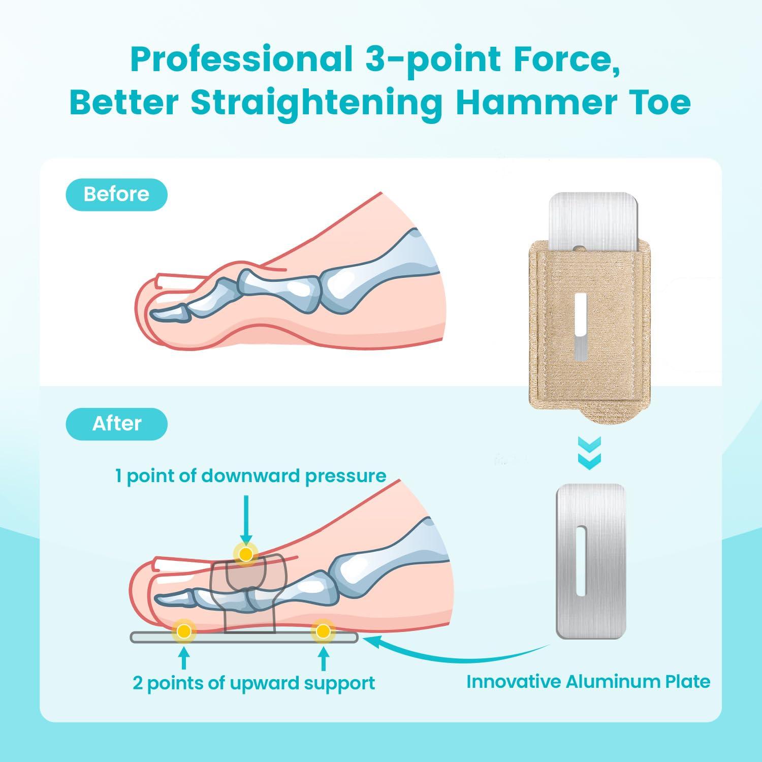 Pozpo Tech Hammer Toe Straightener Corrector Wrap for Women & Men, Hammer Toe Splint Support - 1 in package