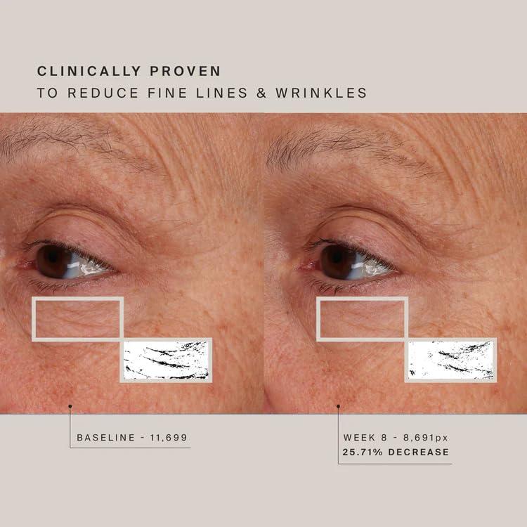 HigherDOSE HigherDOSE Red Light Therapy Face Mask - Cordless At-Home LED Facial Light Therapy - Promotes Cellular Renewal, Healing, & Glowing Skin - LED Face Mask to Target Fine Lines, Wrinkles & Redness