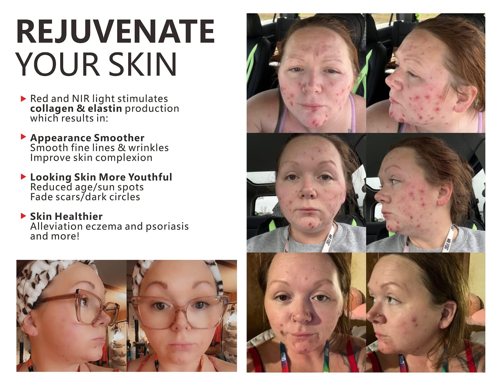 supersred supersred Red Light Therapy Panel, Infrared Red Light Therapy Lamp for Body with Stand, Medical Grade 660nm and 850nm Near Infrared Led Red Light Therapy for Face Device at Home