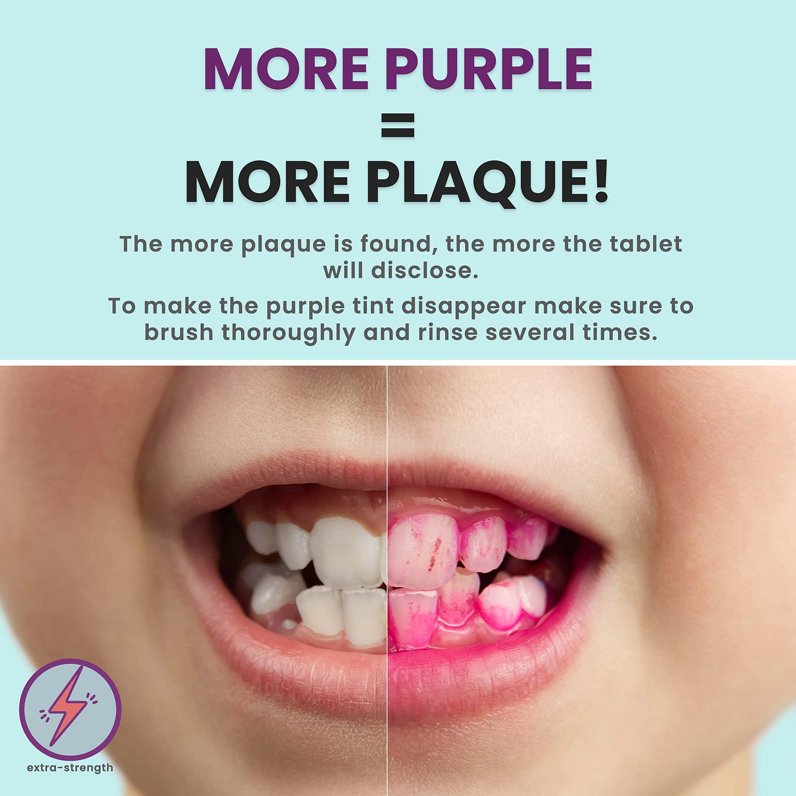 FRESH KNIGHT Plaque Disclosing Tablets for Teeth, 96 Count, Dental Disclosing Tablets for Kids or Adults, Shows Plaque, Helps Teach Kids Teeth-Brushing Habits for Clean Teeth, by Fresh Knight, Pack of (2)